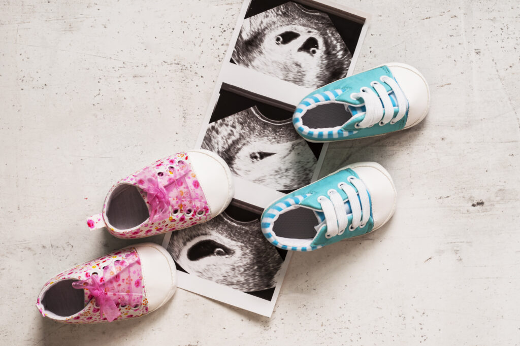 Blue and pink booties next to baby photos with ultrasound in 4th week of pregnancy. Waiting for twins. Son and daughter. Selective focus.